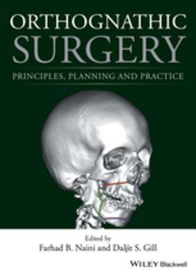 Read Orthognathic Surgery: Principles, Planning and Practice - Farhad B Naini file in PDF