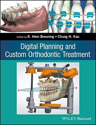 Download Digital Planning and Custom Orthodontic Treatment - K. Hero Breuning | ePub