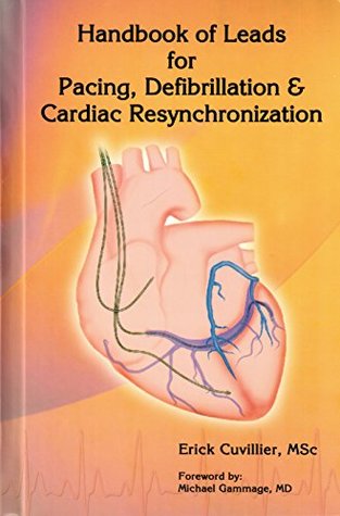 Full Download Handbook of Leads for Pacing, Defibrillation & Cadiac Resynchronization - Erick Cuvillier file in ePub