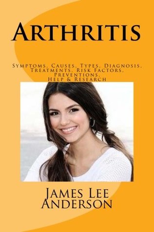 Full Download Arthritis: Symptoms, Causes, Types, Diagnosis, Treatments, Risk Factors, Preventions, Help & Research - James Lee Anderson | ePub